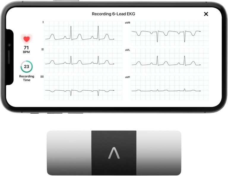 How to Solve Heart Health Concerns with Best 6-Lead EKG Monitor